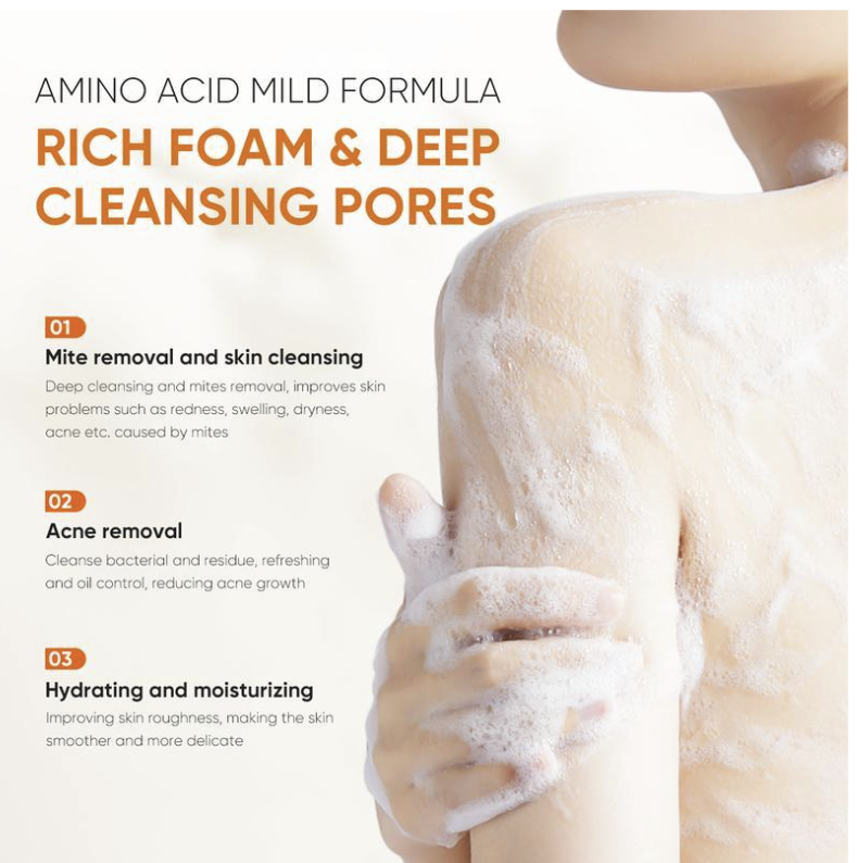 TRATAMIENTO de baño limpiador mite y mcne para el acné
